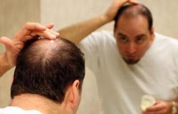 Выпадение волос у женщин – лечение возможно